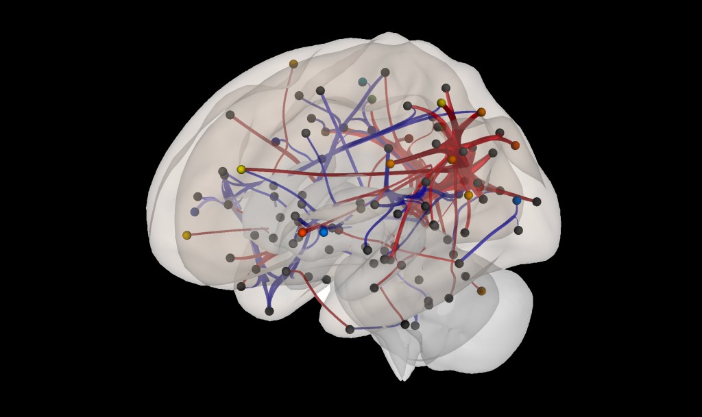 neonatal brain connectivity