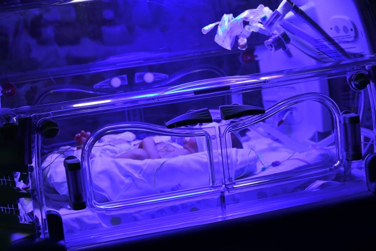 kernicteruscauses, symptoms and treatment