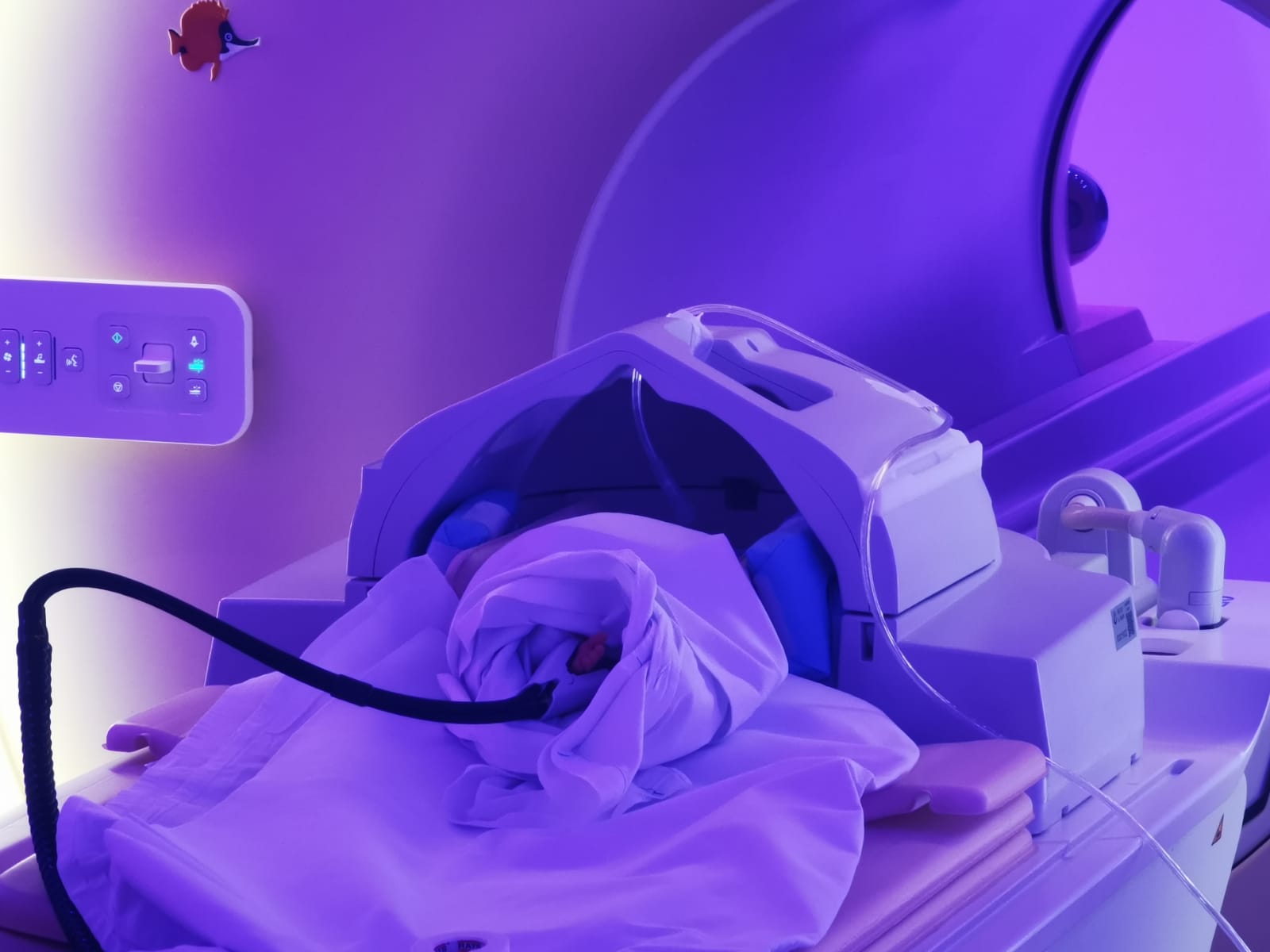 asfissia perinatale EUBRAIN